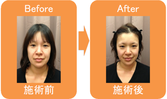小顔矯正(CURE FACE) - 川崎市多摩区・麻生区で肩こり・腰痛・骨盤矯正